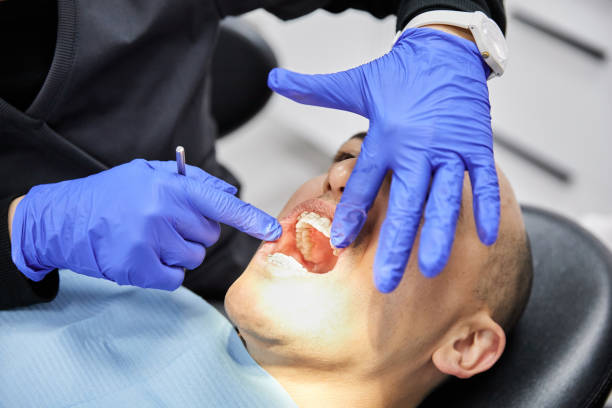 Best Dental Abscess Treatment in Shoshone, ID